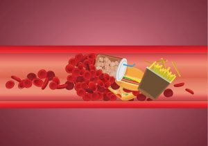 yak-znyzyty-holesteryn-narodnymy-metodamy