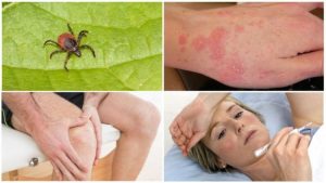 злукова-хвороба-це