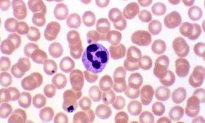 нейтрофіли-це