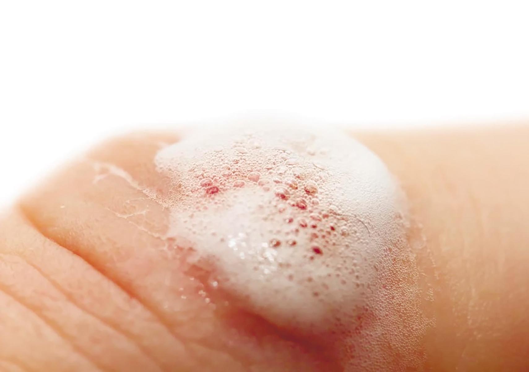 перекис-водню-для-чого