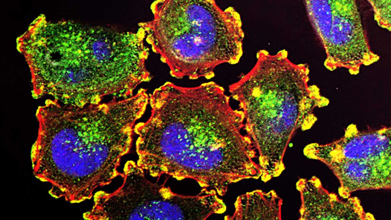 про-що-говорять-підвищені-моноцити