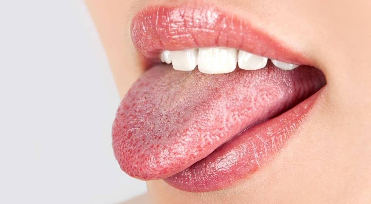 хвороби-язика