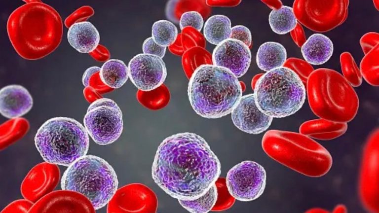 як-знизити-лімфоцити