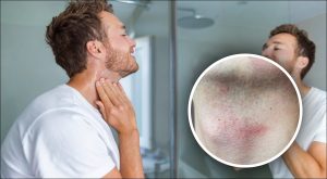 як-позбутися-подразнення-після-бриття