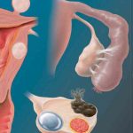 дворога-матка-це