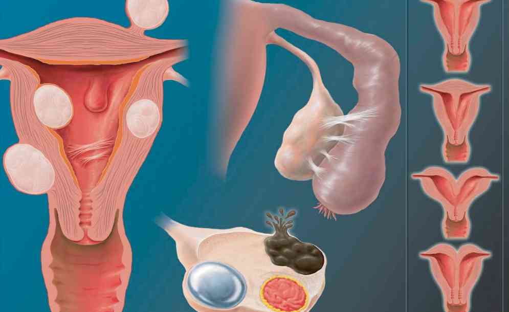 дворога-матка-це
