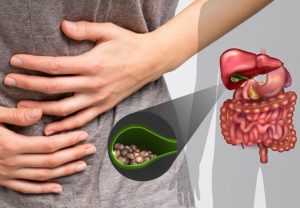 жовчнокам'яна-хвороба-симптоми