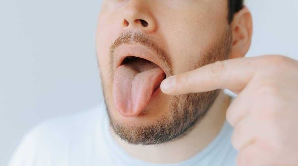 пече-кінчик-язика