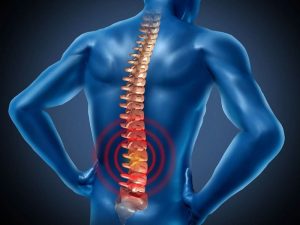 протрузія-симптоми