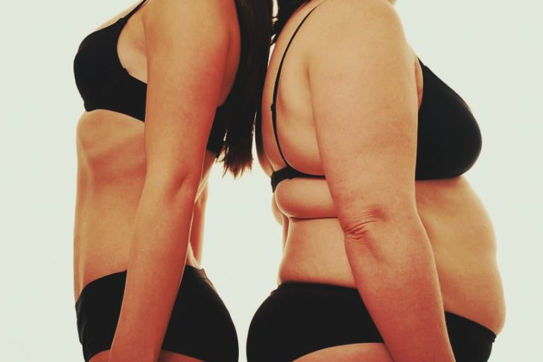 синдром-і-хвороба-іценко-кушинга-різниця