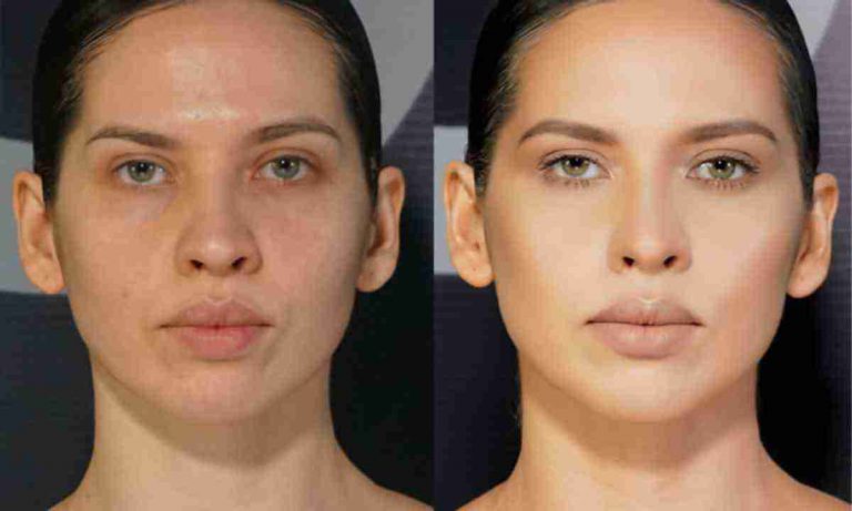 iak-vypravyty-asymetriiu-oblychchia-kompleksnyi-pidkhid-6a5a