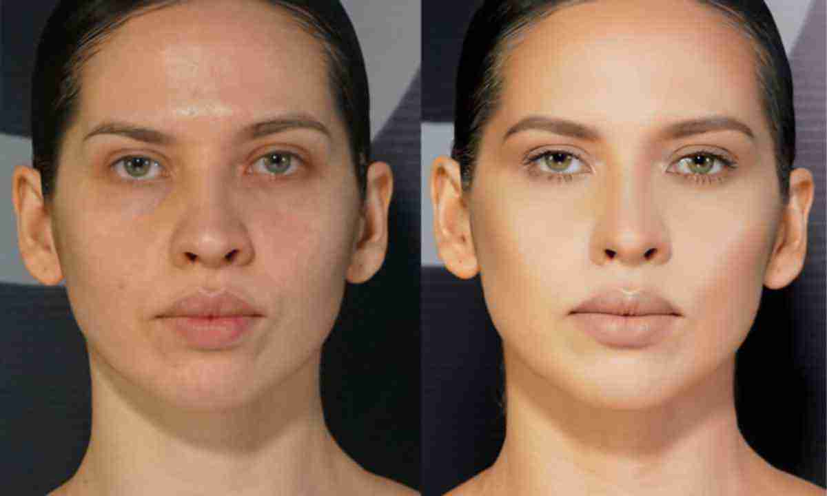 iak-vypravyty-asymetriiu-oblychchia-kompleksnyi-pidkhid-6a5a