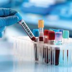 Reasons-to-Get-a-Blood-Test