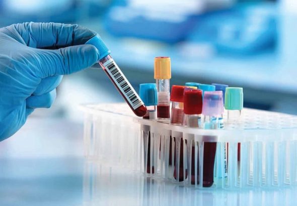 Reasons-to-Get-a-Blood-Test