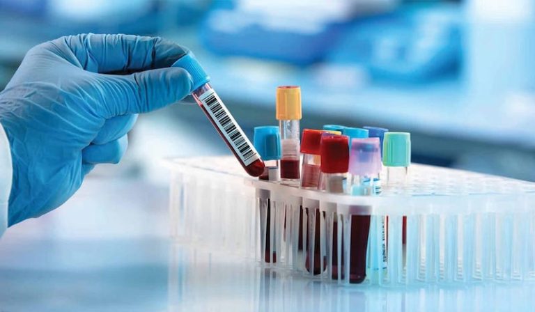 Reasons-to-Get-a-Blood-Test