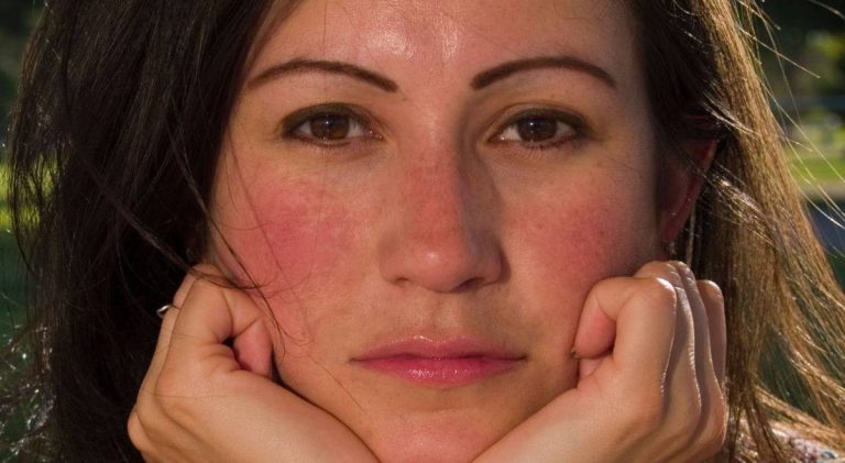 горять щоки